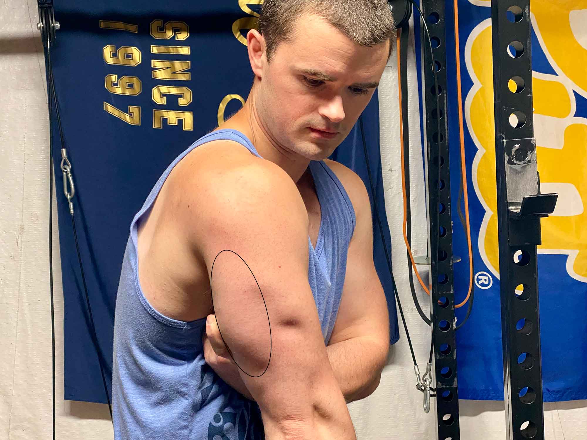 The long head of the triceps