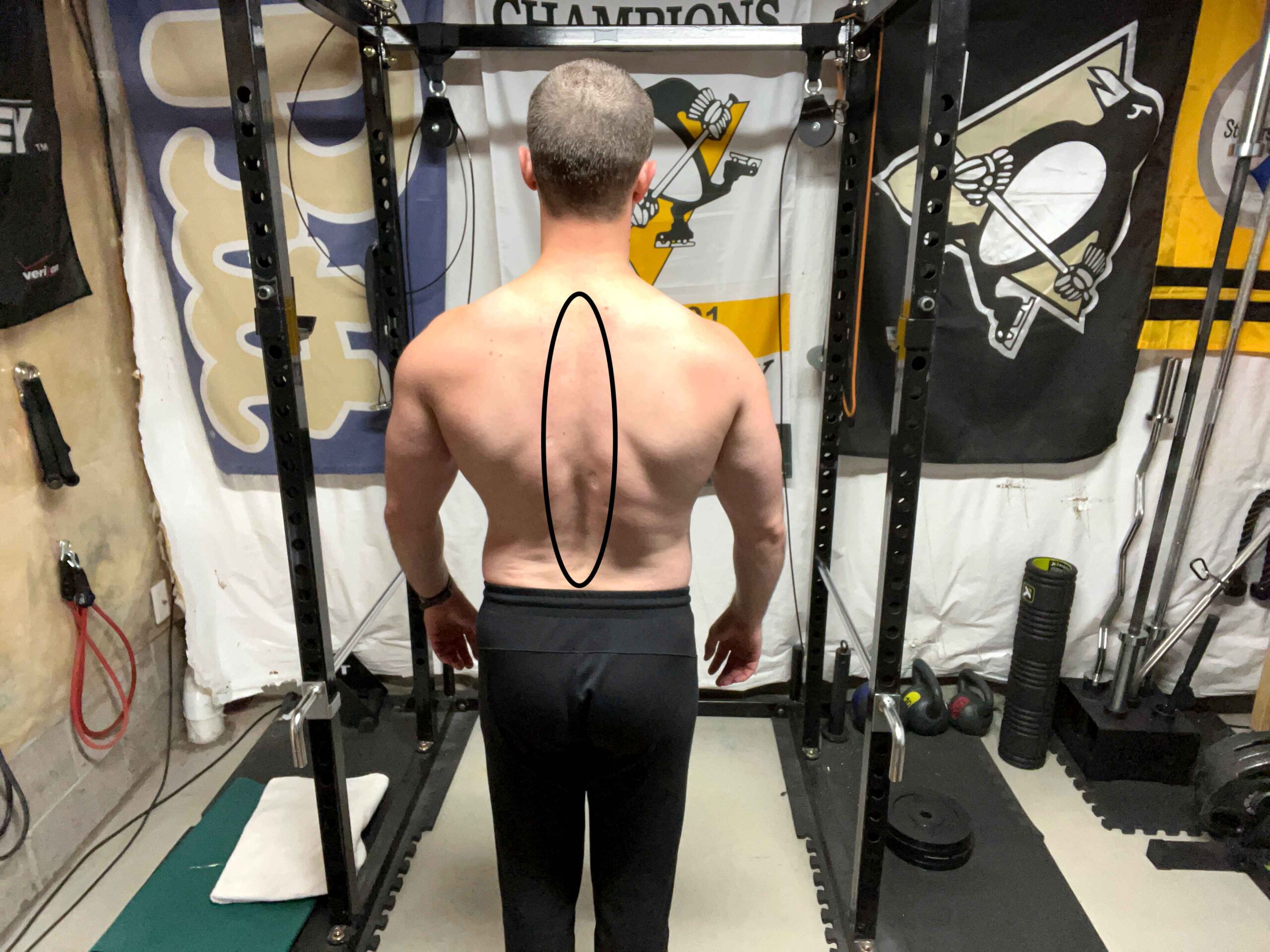 Person posing and showing the spinal erector muscles