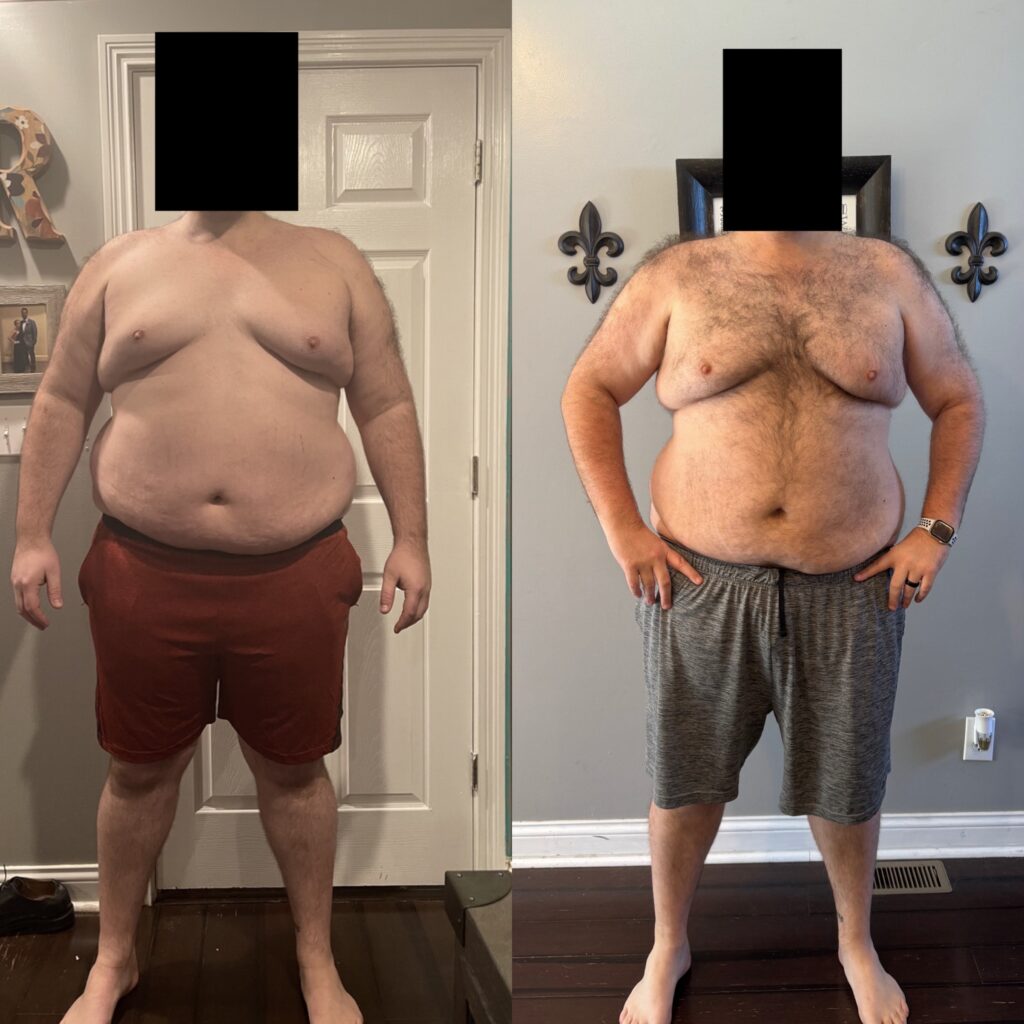 Jim's Before After - Front