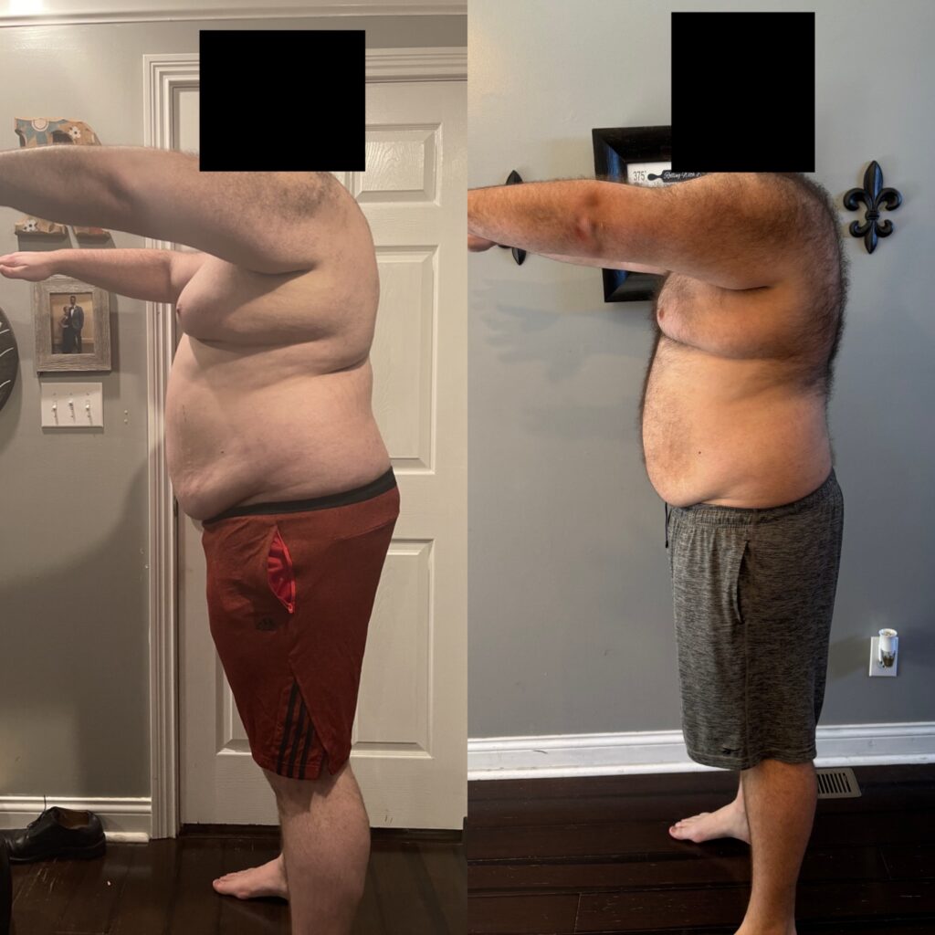 Jim's Before After - Left