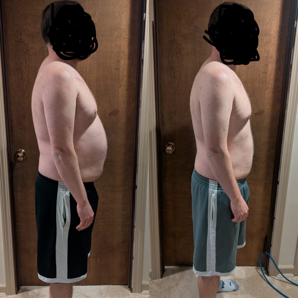 Greg's Before/After Transformation